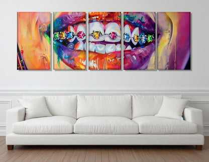 Abstract Braces Canvas – Framed Gallery Wrapped Art | Ready to Hang Orthodontist Wall Decor
