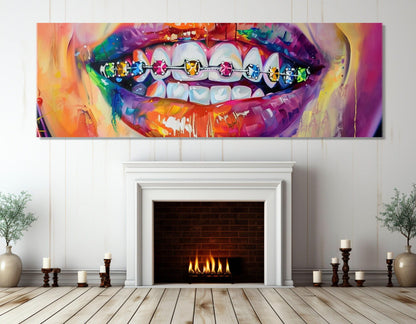 Abstract Braces Canvas – Framed Gallery Wrapped Art | Ready to Hang Orthodontist Wall Decor