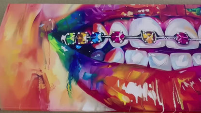 Abstract Braces Canvas – Framed Gallery Wrapped Art | Ready to Hang Orthodontist Wall Decor